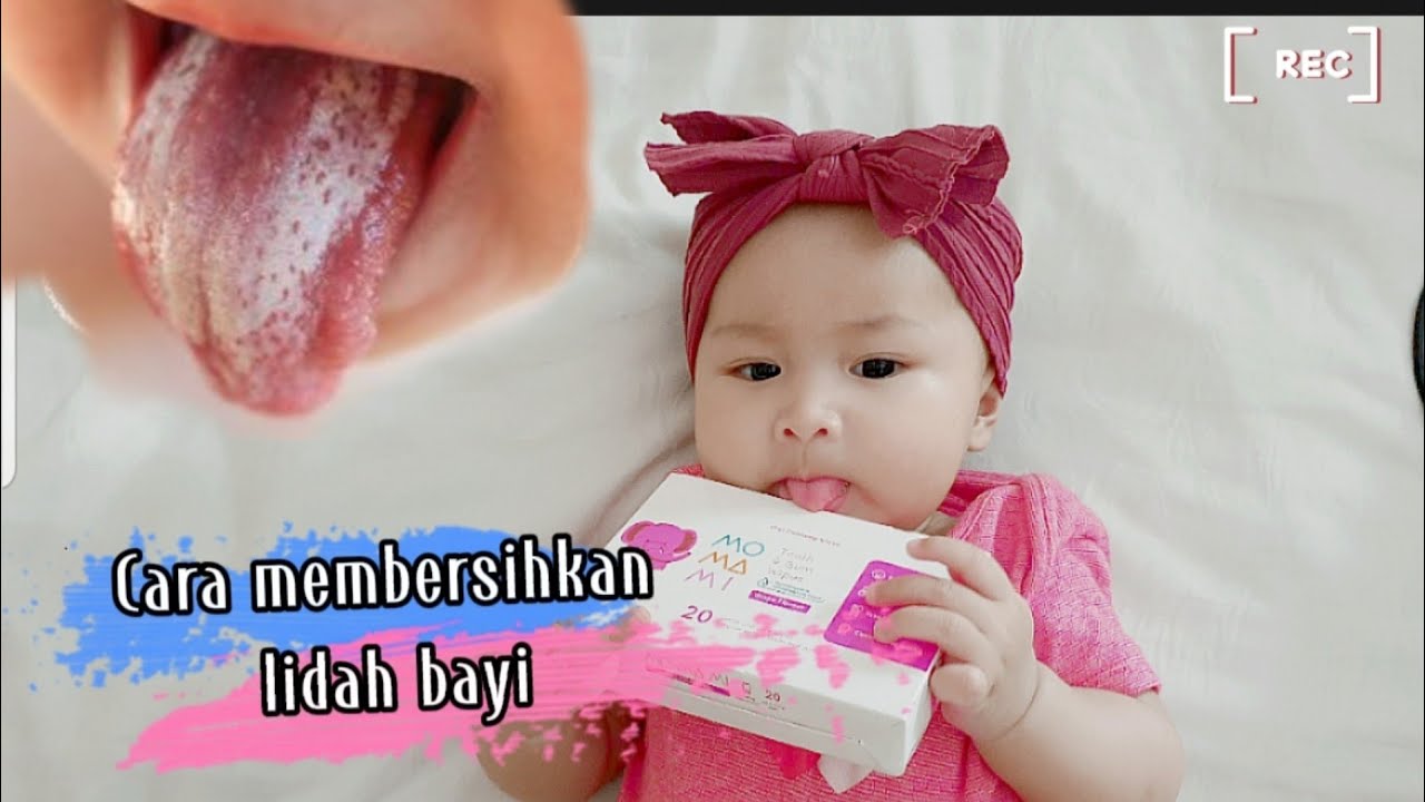 Cara membersihkan lidah putih bayi |Rike I Muliana 
