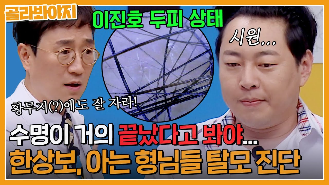 ＂수명이 거의 끝났다고 봐야...＂ 한상보 의사가 보는 💥형님들 탈모 상태 진단💥｜아는형님｜JTBC 230722 방송 외