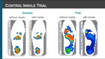 Pediatric Gait Analysis Research Excerpts from Dr. Andrea Coda (PhD, Hons (BSc), Pod)