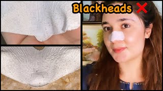 Best Way To Remove “ Blackheads “ !!!
