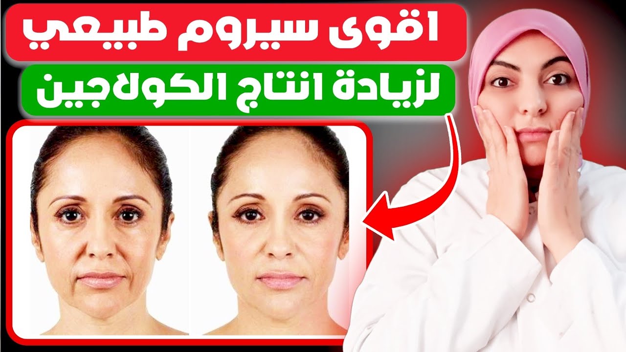 اقوى سيروم كولاجين/كولاجين طبيعي/شد البشرة بدون بوتوكس