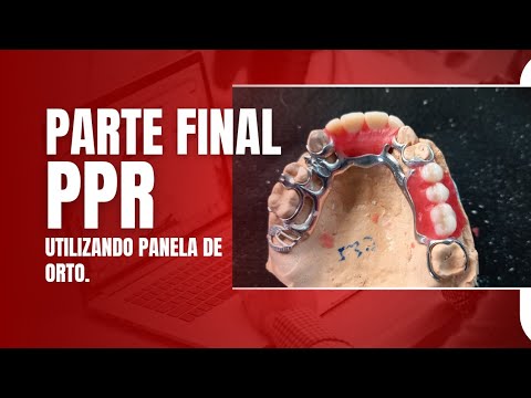 Ppr Rectification PPR MONTAGEM E ACRILIZAÇÃO parte final - YouTube