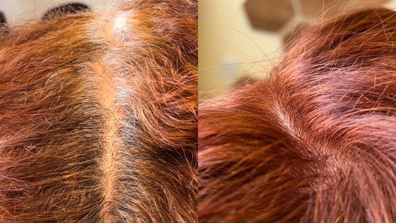Retoque IMPECÁVEL de fios brancos no ruivo