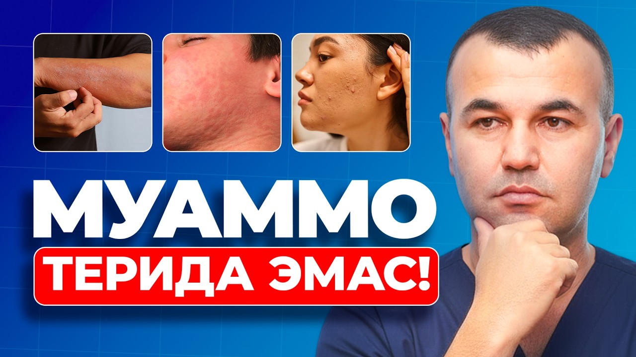 Тери касаллиги нега доим қайталанади? Кўпчилик билмайдиган сабаблар