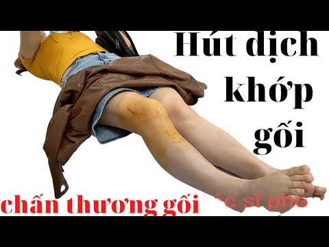 Video Hút dịch khớp gối điều trị tràn dịch khớp gối sau chấn... - youtube