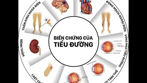 Sinh 11 Bài 9 kế bằng