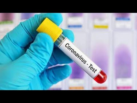 ეპიდემიოლოგიური ვითარება საქართველოში