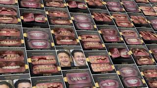 Golden Dental Clinic Cases