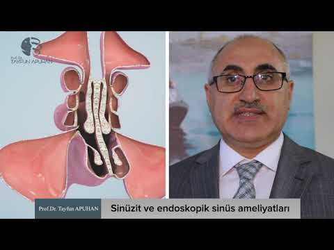 SİNÜZİT VE ENDOSKOPİ SİNÜS AMELİYATLARI 