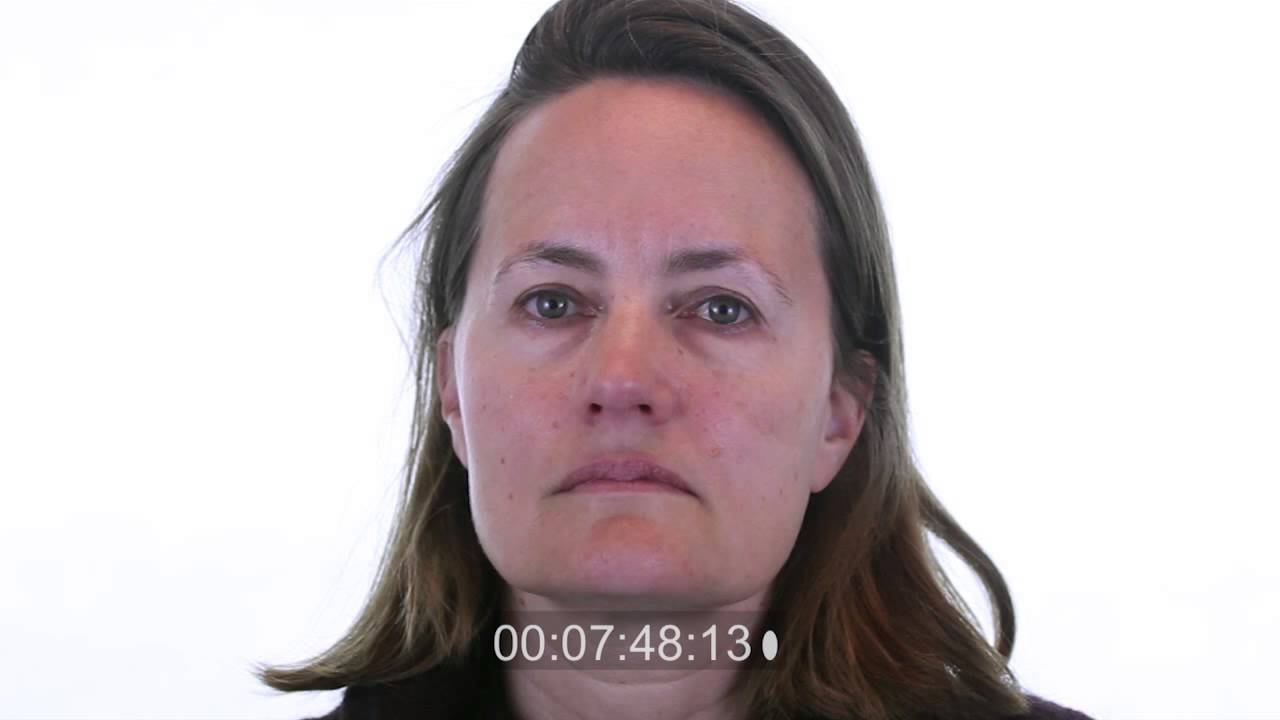 SkinChemists ADVANCED 10-Minute Facelift Before & After