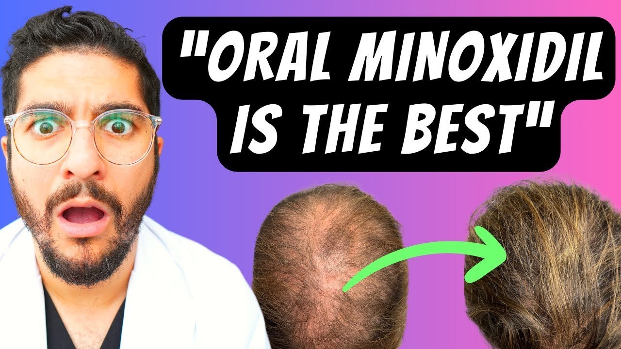 99% Miss This NEW Hair Loss Treatment – Dermatologist Explains - YouTube