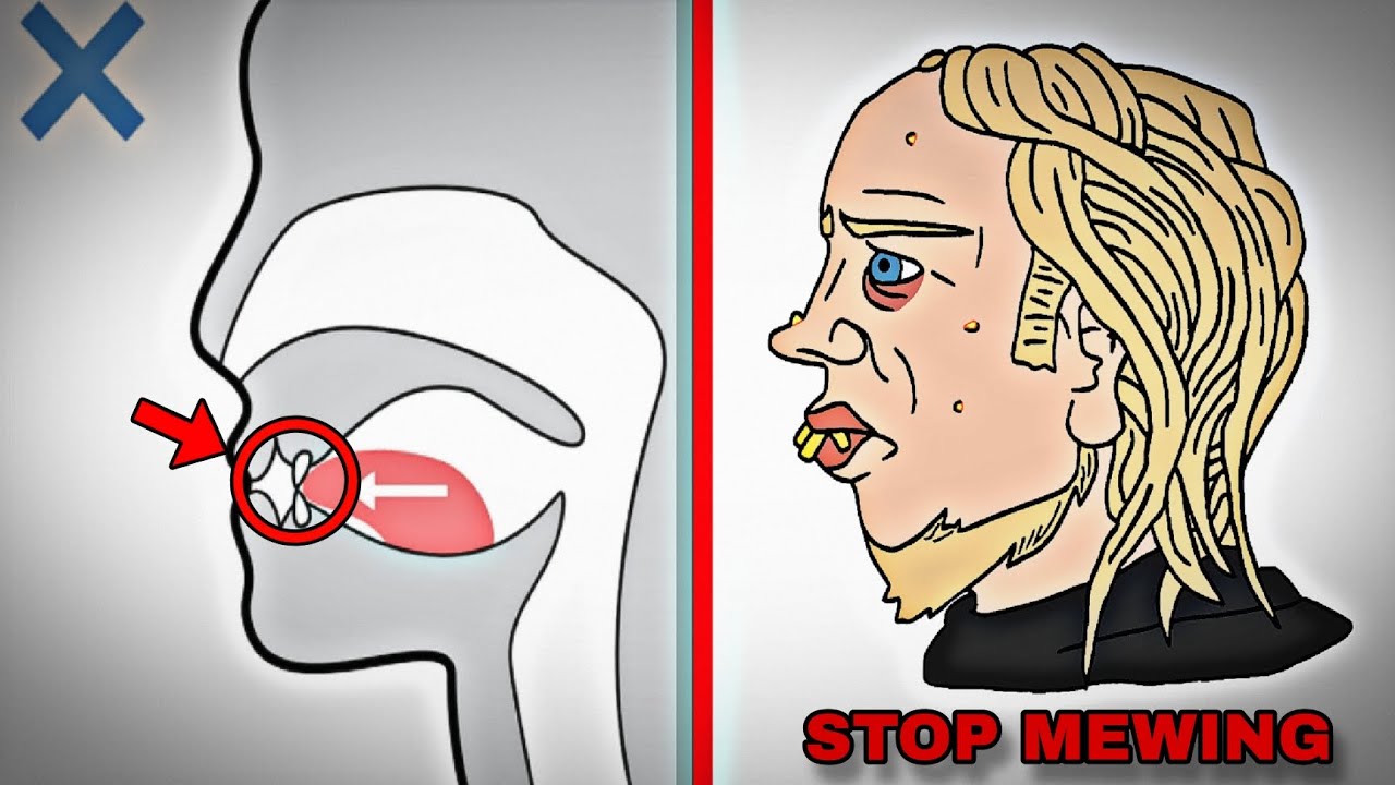 MEWING can destroy your LOOKS (if you do this)