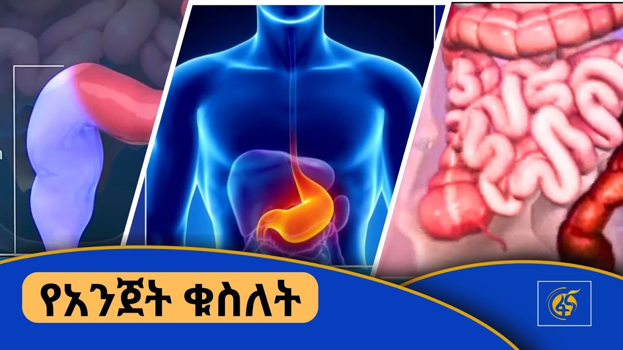 የአንጀት ቁስለት/ ፋና ጤና