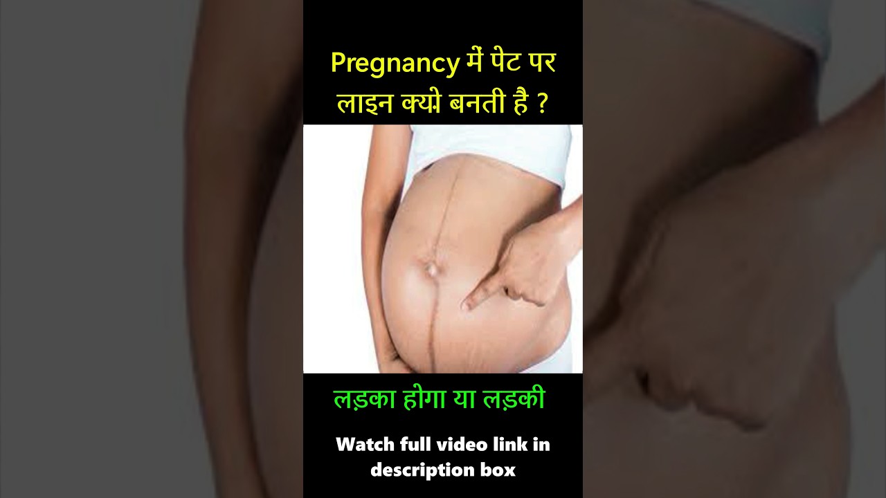 Pregnancy me Pet Par Line Kab Banti Hai l Linea Nigra During Pregnancy #shorts #boyorgirl #hindi