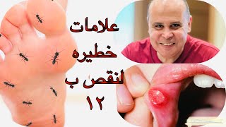 علامات خطيره في جسمك تكشف نقص فيتامين ب١٢ ?الجلوكوفاج ونقص ب١٢?التهاب الاعصاب مع مرضي السكر