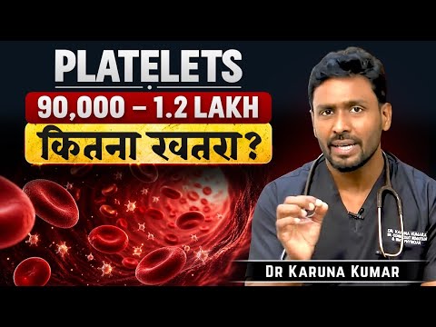 Platelet Count 90,000: Don't Panic Until You Watch This