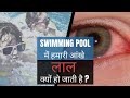 Swimming Pool में नहाने के बाद आंखे लाल क्यों हो जाती है | YVEL Protective Facemask | #facts#fact