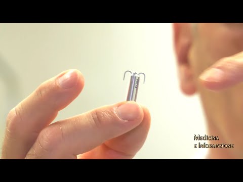 Video: Dove mettono un pacemaker?