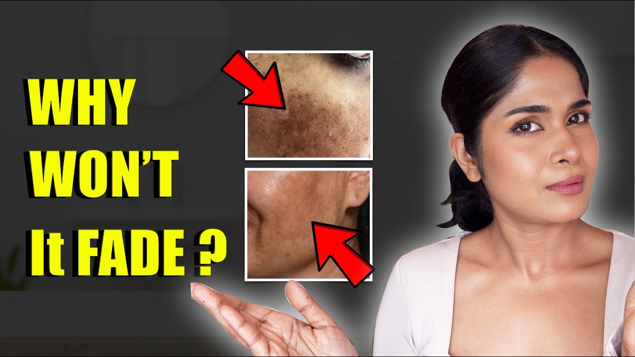 Why Your Dark Spots Aren’t Fading After 35?