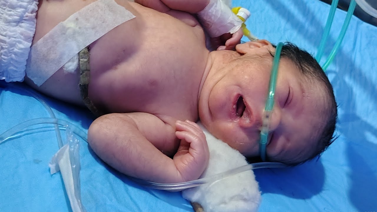 Premature Baby Pritam in Critical Condition 😭 | Baby on Life-Saving Machines | Watch Live 🙏