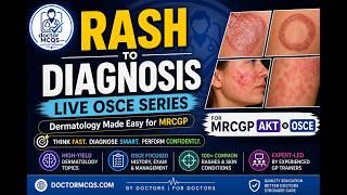 RASH TO DIAGNOSIS – LIVE OSCE SERIES | Dermatology Made Easy for MRCGP (AKT + OSCE)