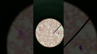 Blood smear erythrocyte leukocyte platelet histology
