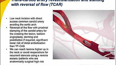 Defining High risk patients for TCAR; How to avoid complications.