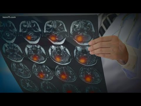 Doctor and stroke survivor warn people experiencing stroke symptoms to seek help