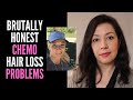 CHEMOTHERAPY AND MY HAIR LOSS AND REGROWTH STORY | Color? More Curly? Eyebrows? Lashes? Cold Cap?