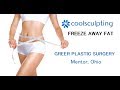 👗  Coolsculpt before and after in Mentor Ohio - coolsculpting Mentor Ohio ~ Greer Plastic Surgery