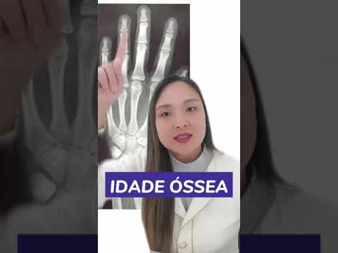 O que é o Raio X de Idade óssea?