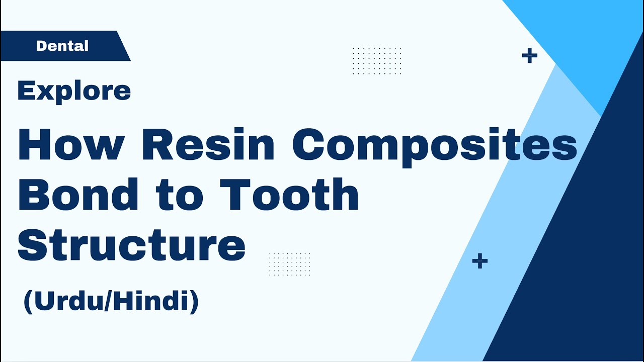 Adhesive Restorative Materials: Bonding of Resin-Based materials