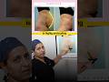You won’t believe this before & after! 😲A total postpartum body transformation #postpartum #shorts