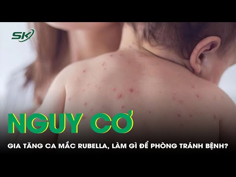 Nguy Hiểm Bệnh Truyền Nhiễm Rubella, Điều Trị Bệnh Như Thế Nào 