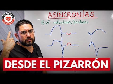 🫁 Patient–Ventilator Asynchrony: Current Concepts Explained on the Whiteboard
