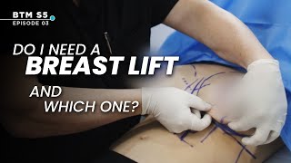 The TRUTH About Breast Lifts: Do You REALLY Need One? | BTM5 Ep.3