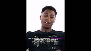 Celebrity NBA Youngboy Explains The Scars On His Forehead #nbayoungboy #rap #yb Wealth