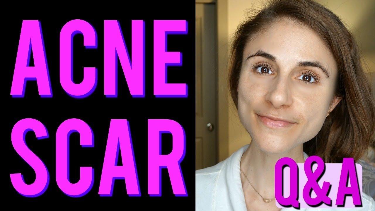 ACNE SCAR Q&A: laser peels, microneedling, creams, silicone.  💊