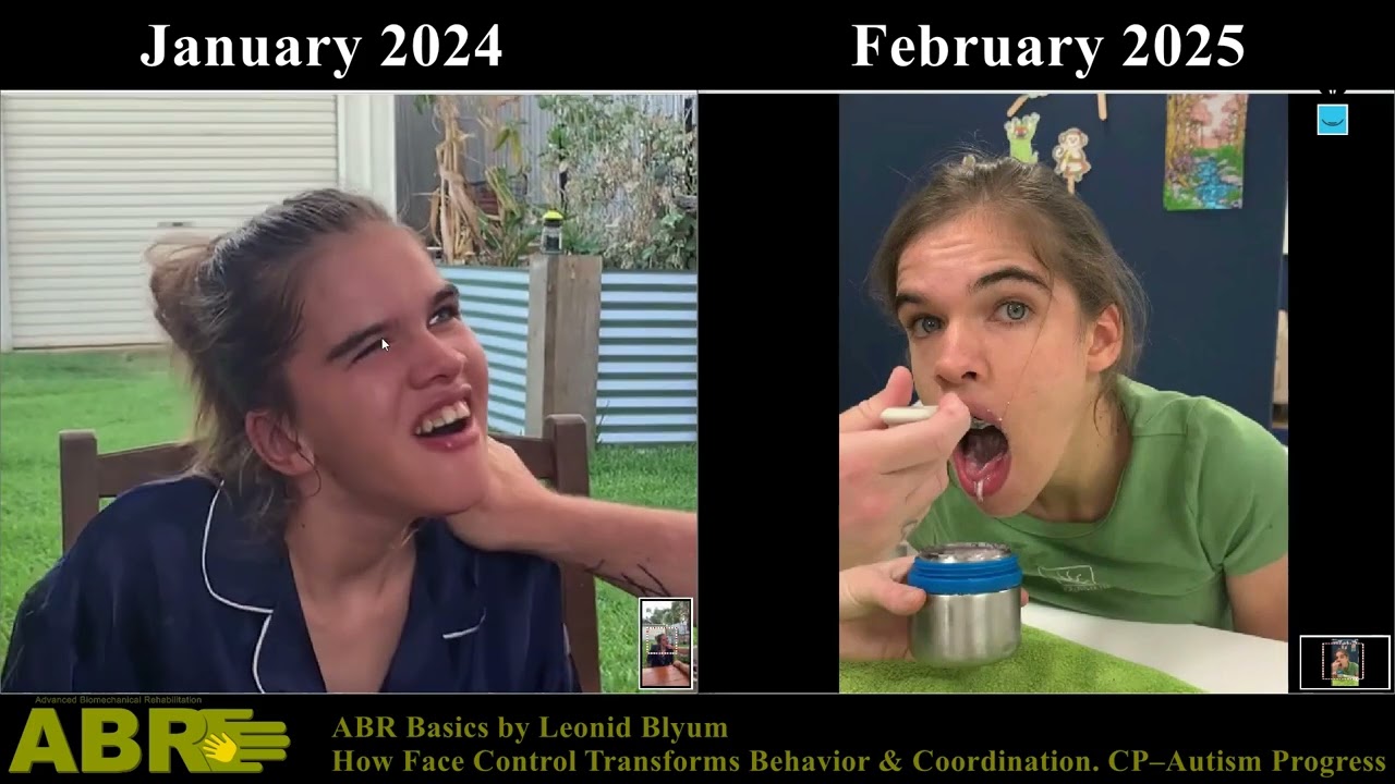 ABR – Face Control Improves Behavior & Movement  CP–Autism Progress Explained by Leonid Blyum