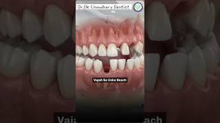 Missing Tooth#dentist#Extraction #painlessdentistry#dentalimplants #viralshorts#reels #faizullaganj