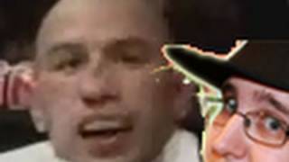 Brandon Vera Has Horrible Broken Nose After Fight With Thiago Silva UFC 125