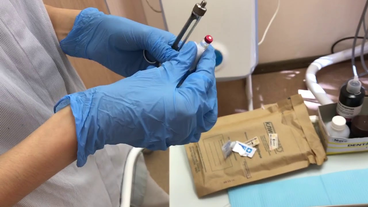 Карпульная анестезия