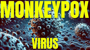 Monkeypox Virus Explained: Symptoms, Spread, and Prevention