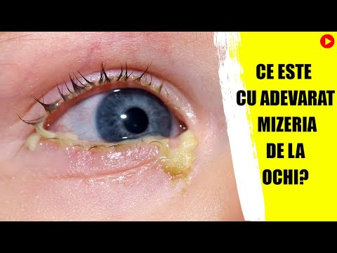 Video: Când ceva este mizerie?