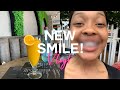 VLOGMAS | I got a New smile! | OG Parley