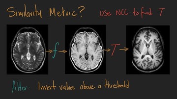 v27 - Intensity-based Registration - Week 9: Image registration