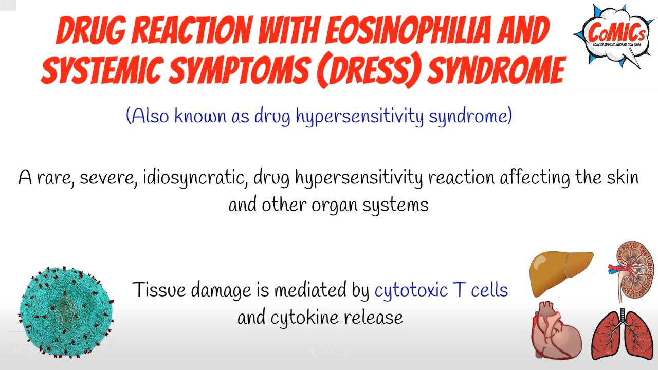 DRESS Syndrome (Drug Related Eosinophilia) - Causes, Pathophysiology, Signs  and Symptoms, Treatment • Video •