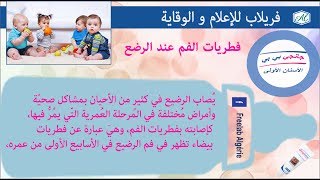 V0030  ما تجهلين عن تقرحات الفم و حلها LES APHTES CHEZ BÉBÉ