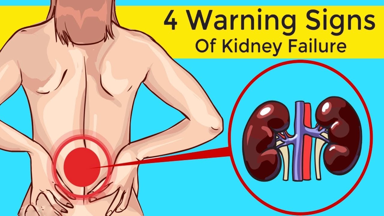 Don't Ignore These 4 Warning Signs Of Kidney Failure YouTube