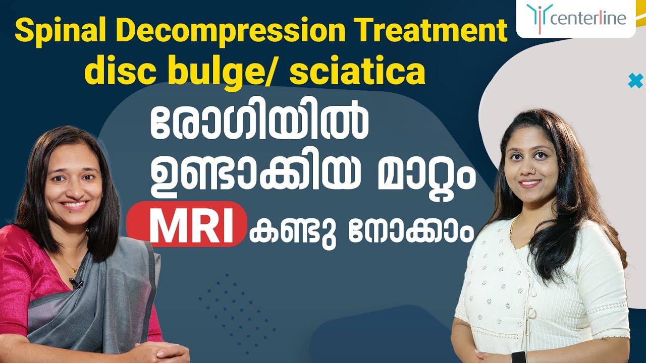 Spinal Decompression Treatment - disc bulge/ sciatica  രോഗിയിൽ ഉണ്ടാക്കിയ മാറ്റം, MRI കണ്ടു നോക്കാം